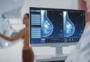 SDI de Santa Cruz do Rio Pardo dispõe de mamografia digitalizada