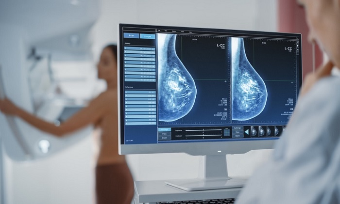 SDI de Santa Cruz do Rio Pardo dispõe de mamografia digitalizada